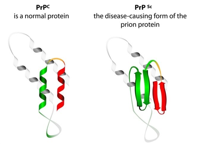 Maladie À Prion