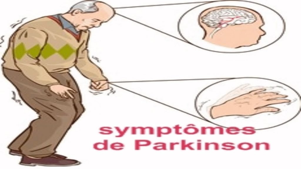 Maladie De Parkinson Symptômes