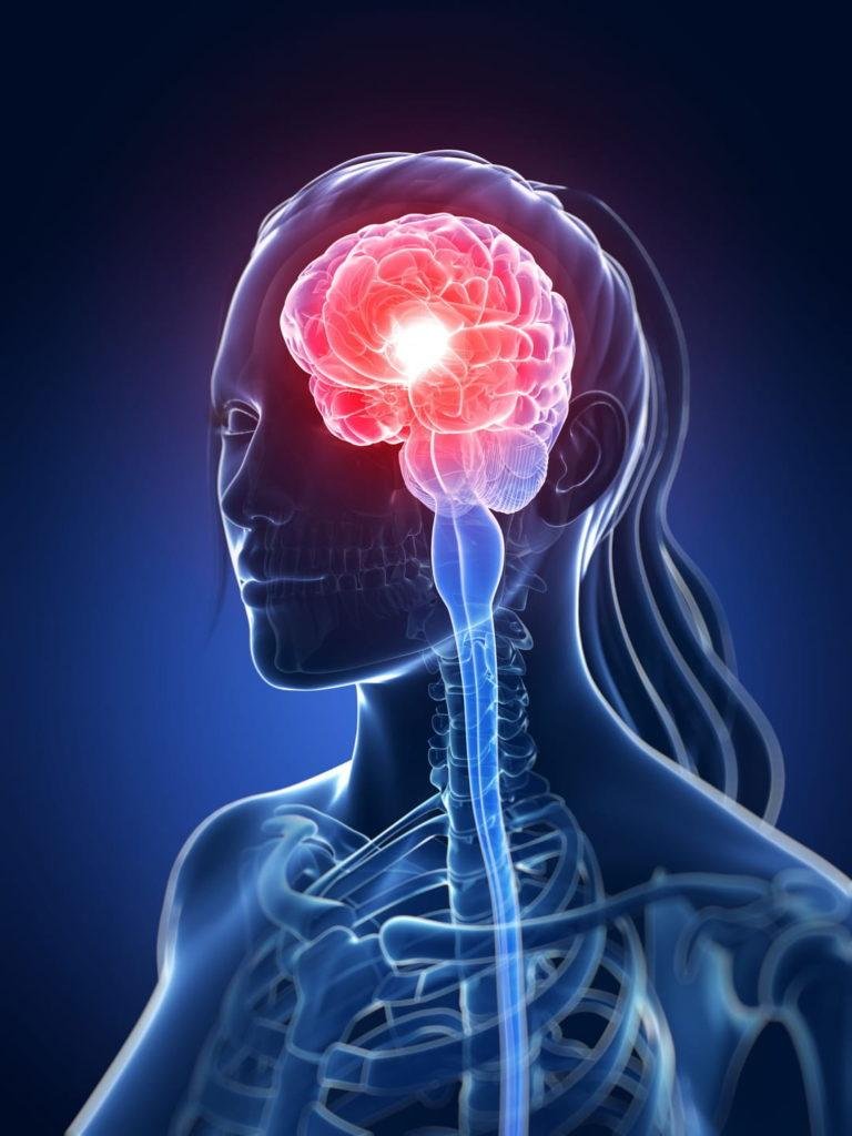 Tumeur Au Cerveau Témoignage Symptôme