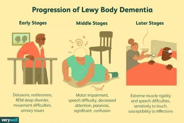 Maladie Ã€ Corps De Lewy SymptÃ´mes