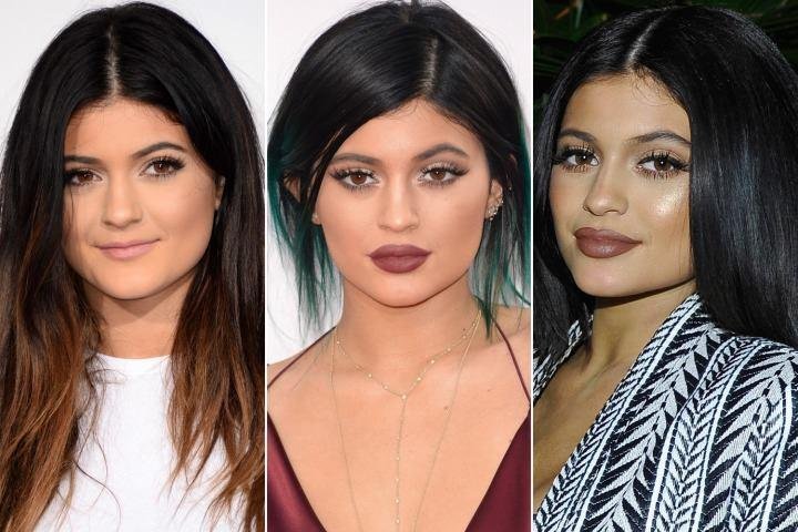 Kylie Jenner Avant Chirurgie