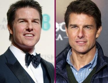 Tom Cruise Chirurgie
