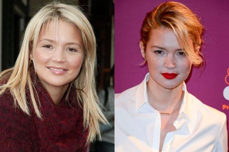 Virginie Efira Chirurgie