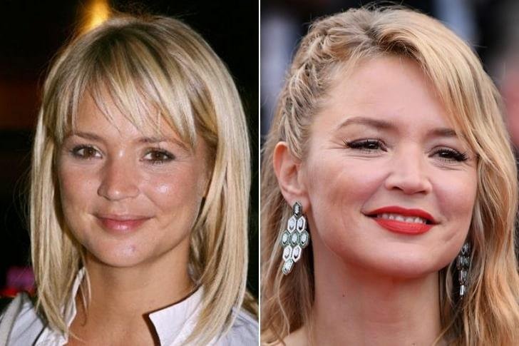 Virginie Efira Chirurgie