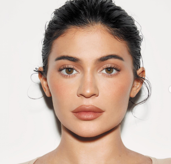 Kylie Jenner Avant Chirurgie