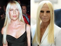 Donatella Versace chirurgie